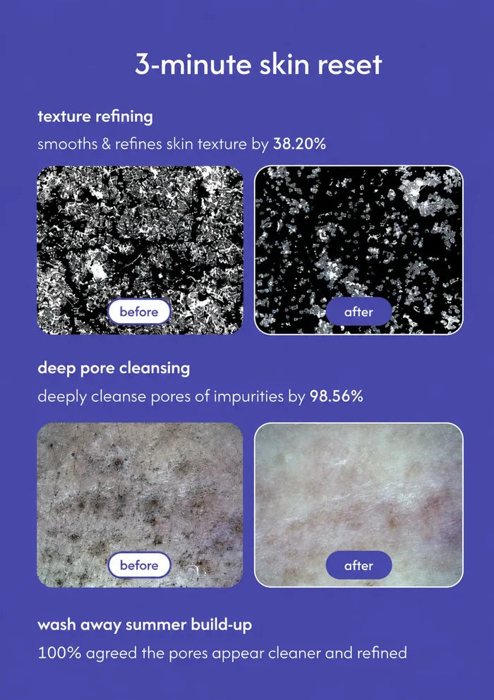 A promotional graphic for a '3-minute skin reset' showing before-and-after skin texture results on a purple background. The text lists three benefits: 'texture refining' with 38.